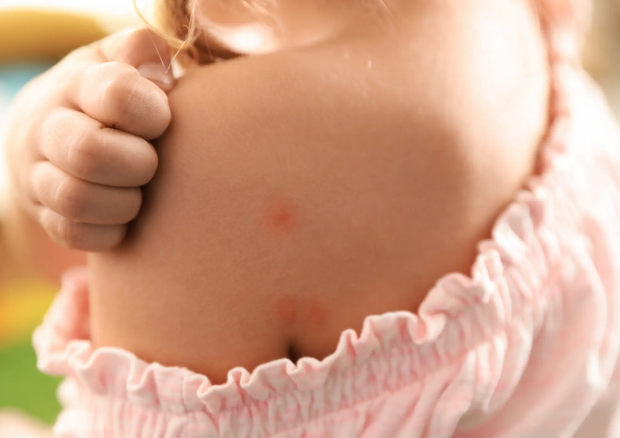 Jak chronić niemowlę przed komarami